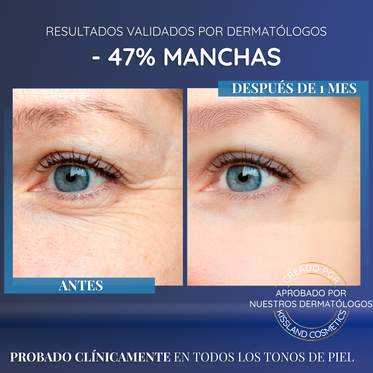 Serum Antimanchas Facial con Niacinamida Pura (Vitamina B3) y Ácido Salicílico 60 ml