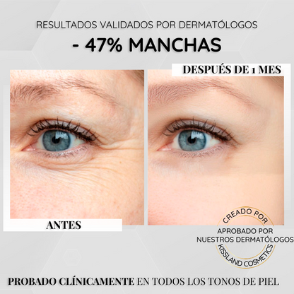 Serum Antimanchas Facial con Niacinamida Pura (Vitamina B3) y Ácido Salicílico 60 ml